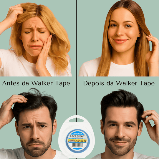 Fita Adesiva Capilar Mega Hair Prótese Walker Tape Lace Front Extra Forte - Todos os Tamanhos